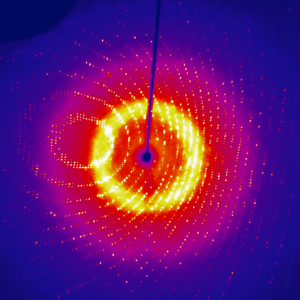 X-ray diffraction image